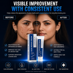 ScarSmooth | Scar Repair Cream for All Types of Marks