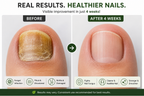 AyuSure Nail Repair Oil