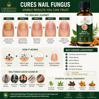 AyuSure Nail Repair Oil