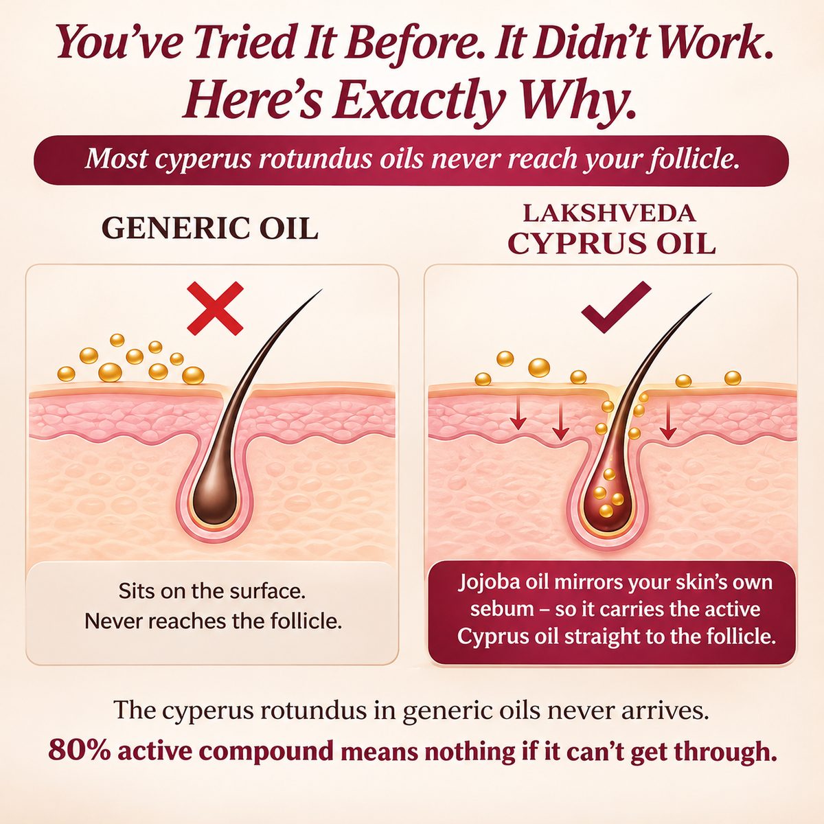 AyuSure Cyprus Rotundus Oil