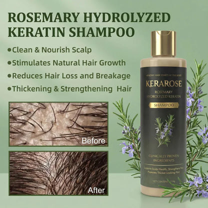 Kerarose Rosemary Shampoo For Hair Growth (Buy 1 Get 1 Free)