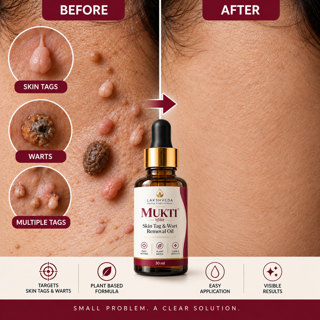 AyuSure Mukti | Skin Tag Remover Oil