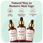 AyuSure Mukti | Skin Tag Remover Oil